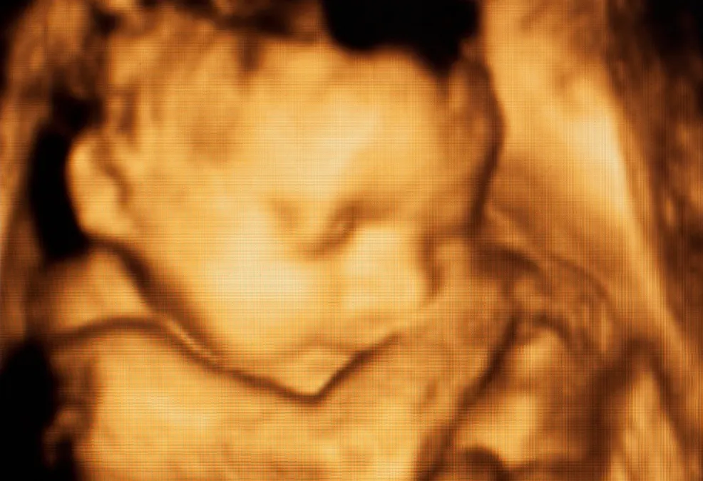 klinik-scan-baby-near-me