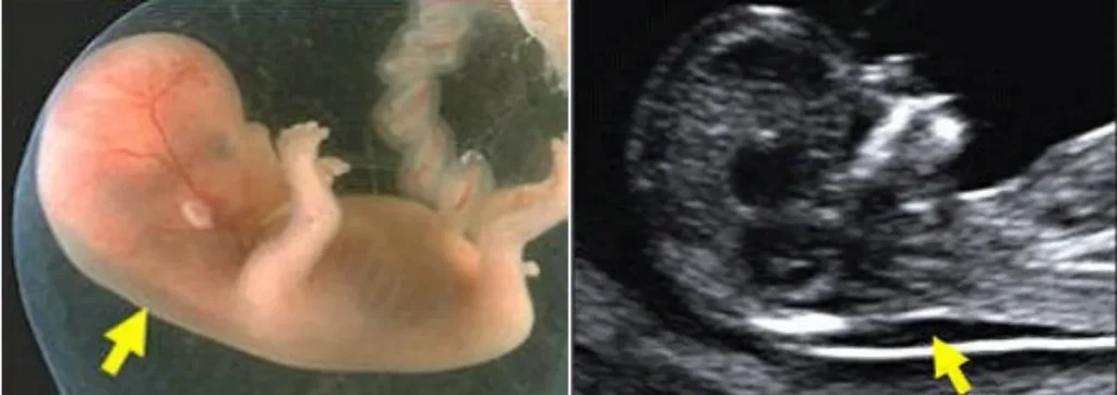 klinik-scan-baby-near-me