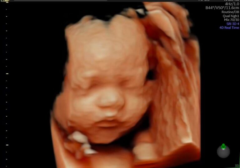 Bila Waktu Sesuai Untuk Buat Pregnancy Scan?