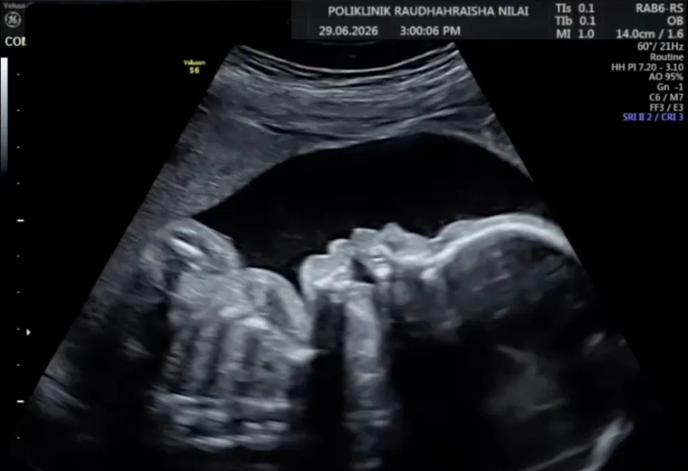 details-scan-baby-ultrasound