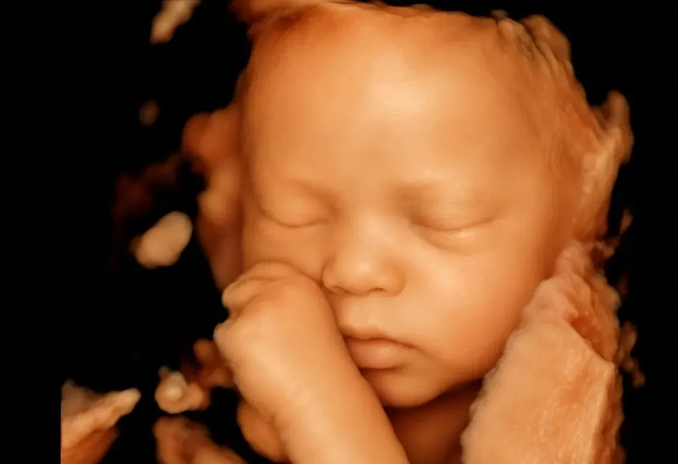details-scan-baby-5d-scan