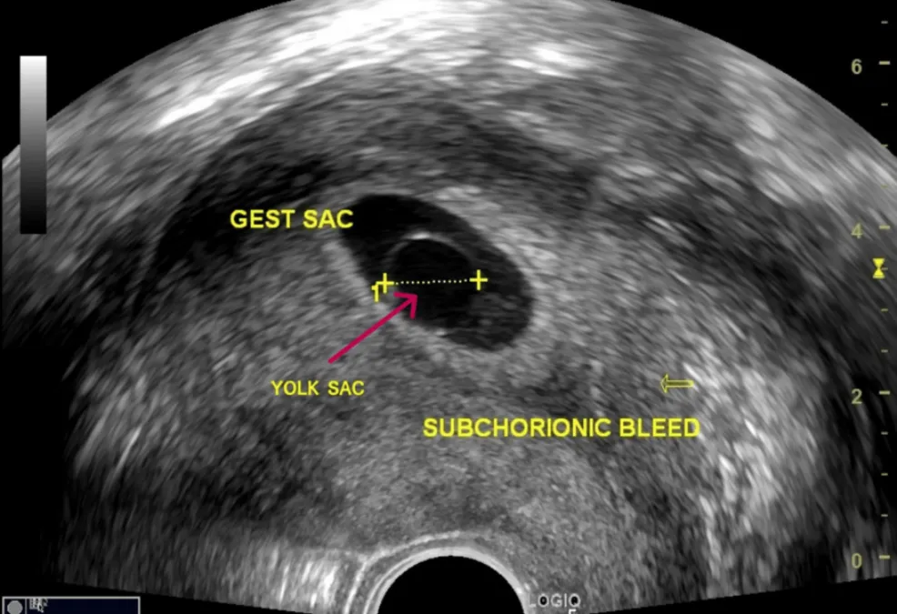 pregnancy-details-scan
