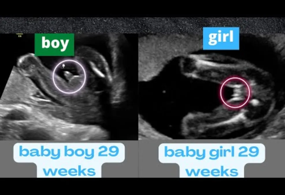 gender details scan baby