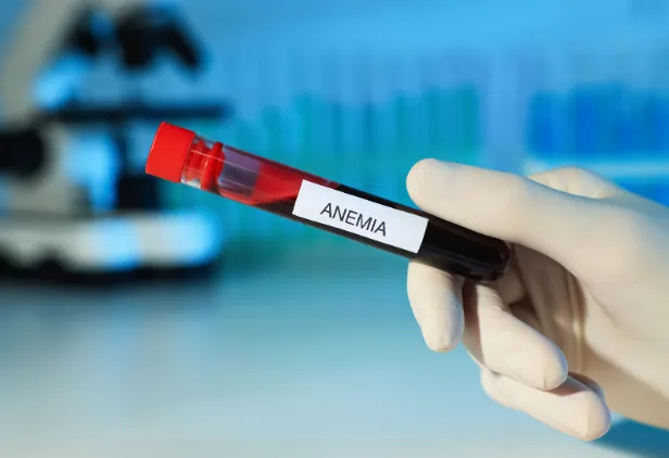 anemia
